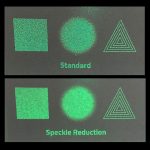 SLM-speckle-reduction1-150x150-1.jpg.pagespeed.ce_.iSCji_6t-8-1